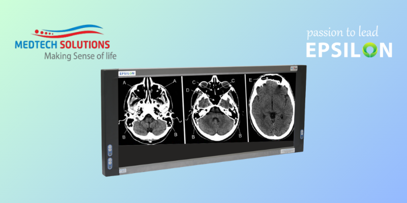 X-Ray Fim viewer (View Box) Triple Film